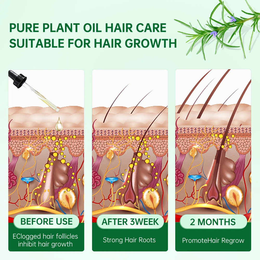 PURC Rosemary Hair Oil